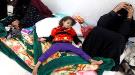الأمم المتحدة: أكثر من 11 ألف حالة كوليرا و75 وفاة في مناطق الحوثيين خلال شهر 