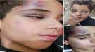 جريمة مروعة بحق الطفل ضياء في صنعاء.. تفاصيل مؤلمة